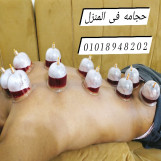حجامه فى المنزل 01018948202