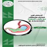 بالون المعدة في الكويت مع د. فهد الإبراهيم-الحل الآمن والفعّال لفقدان الوزن